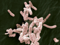 Agrobacterium radiobacter - Agrobacterium tumefaciens.png